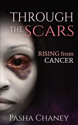 Through the Scars: Rising from Cancer