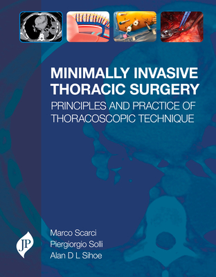 Minimally Invasive Thoracic Surgery By Marco Scarci, Piergiorgio Solli, Alan Sihoe Cover Image