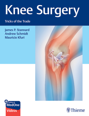Knee Surgery: Tricks of the Trade By James Stannard, Andrew Schmidt, Mauricio Kfuri Cover Image
