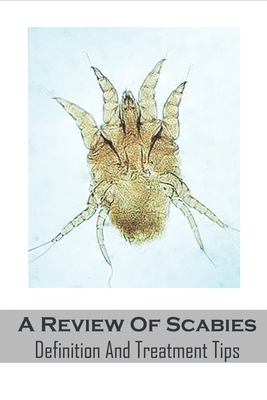 A Review Of Scabies_ Definition And Treatment Tips: Scabies Treatment Guide Book Cover Image