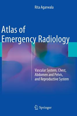 Atlas of Emergency Radiology: Vascular System, Chest, Abdomen and Pelvis, and Reproductive System Cover Image