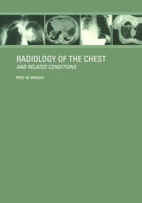 Radiology of the Chest and Related Conditions: Together with an Extensive Illustrative Collection of Radiographs, Conventional and Computed Tomograms, By F. W. Wright Cover Image