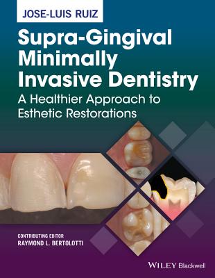 Supra-Gingival Minimally Invasive Dentistry By Jose-Luis Ruiz Cover Image