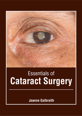 Essentials Of Cataract Surgery (Hardcover) | Hooked