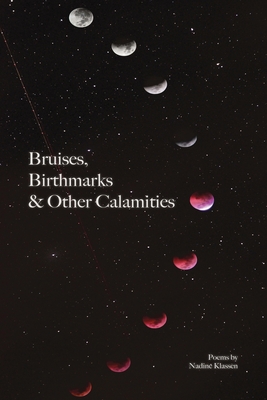Bruises, Birthmarks & Other Calamities (Paperback)