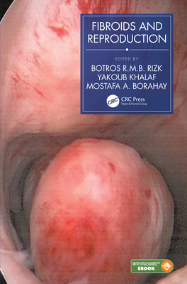 Fibroids and Reproduction Cover Image