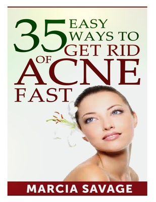 35 Easy Ways To Get Rid Of Acne Fast By Marcia Savage Cover Image