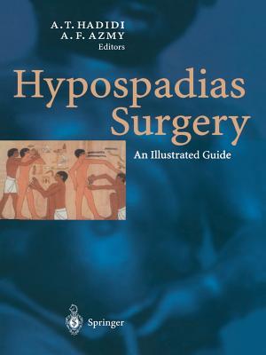 Hypospadias Surgery: An Illustrated Guide By Ahmed Hadidi (Editor), Montgomery David a. (Editor) Cover Image