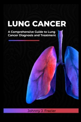 Lung cancer: A Comprehensive Guide to Lung Cancer Diagnosis and Treatment Cover Image