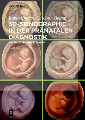 3d-Sonographie in Der Pränatalen Diagnostik: Ein Praktischer Leitfaden Cover Image