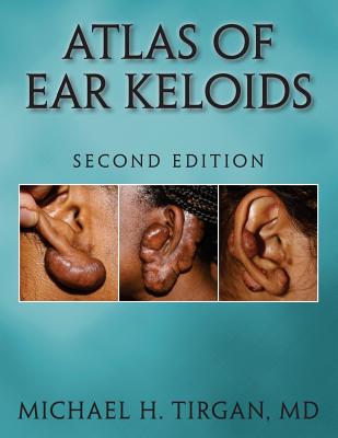 Atlas of Ear Keloids - Second Edition Cover Image