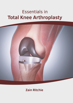 Essentials in Total Knee Arthroplasty Cover Image