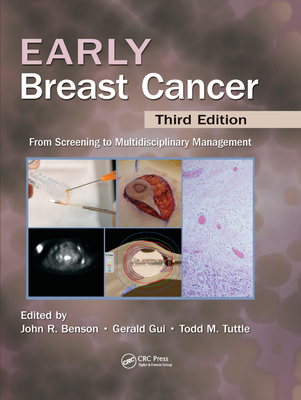 Early Breast Cancer: From Screening to Multidisciplinary Management, Third Edition By John R. Benson (Editor), Gerald P. H. Gui (Editor), Todd Tuttle (Editor) Cover Image
