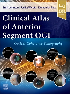 Clinical Atlas of Anterior Segment Oct: Optical Coherence