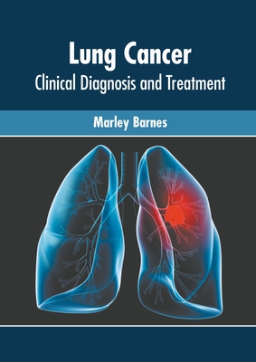 Lung Cancer: Clinical Diagnosis and Treatment By Marley Barnes (Editor) Cover Image