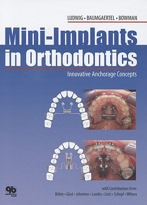 Mini-Implants in Orthodontics: Innovative Anchorage Concepts By Bjorn Ludwig, Sebastian Baumgaertel, Bernhard Bohm Cover Image