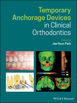 Temporary Anchorage Devices in Clinical Orthodontics Cover Image