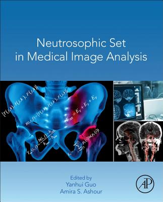 Neutrosophic Set in Medical Image Analysis Cover Image