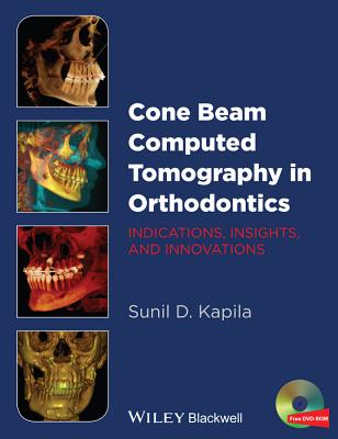 Cone Beam Computed Tomography in Orthodontics: Indications, Insights, and Innovations Cover Image