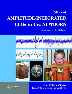 An Atlas of Amplitude-Integrated Eegs in the Newborn [With DVD ROM] Cover Image