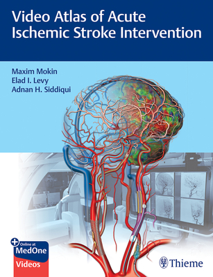 Video Atlas of Acute Ischemic Stroke Intervention By Maxim Mokin, Elad Levy, Adnan Siddiqui Cover Image