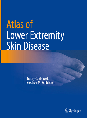 Atlas of Lower Extremity Skin Disease Cover Image