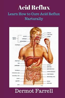 Acid Reflux: Learn How to Cure Acid Reflux Naturally (Natural Health Solutions #6)