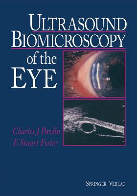 Ultrasound Biomicroscopy of the Eye Cover Image