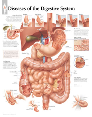 Diseases of Digestive System Chart: Wall Chart Cover Image