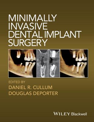 Minimally Invasive Dental Implant Surgery Cover Image