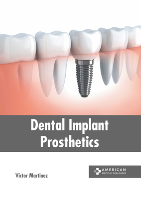 Dental Implant Prosthetics Cover Image