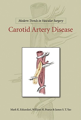Modern Trends in Vascular Surgery: Carotid Artery Disease Cover Image