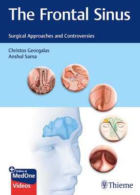 The Frontal Sinus: Surgical Approaches and Controversies By Christos Georgalas (Editor), Anshul Sama (Editor) Cover Image