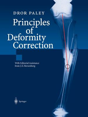 Principles of Deformity Correction Cover Image