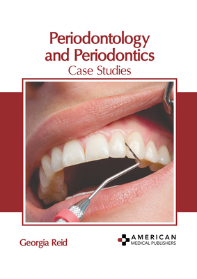 Periodontology and Periodontics: Case Studies Cover Image