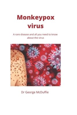 Monkeypox virus: A rare disease and all you need to know about the virus By George McDuffie Cover Image