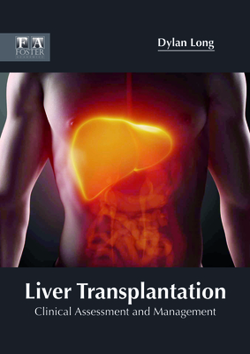 Liver Transplantation: Clinical Assessment and Management By Dylan Long (Editor) Cover Image