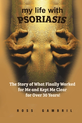 my life with PSORIASIS: The story of what finally worked for me and kept me clear for over 30 years! By Ross Gambril Cover Image