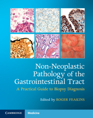 Non-Neoplastic Pathology of the Gastrointestinal Tract with Online Resource: A Practical Guide to Biopsy Diagnosis [With Access Code] Cover Image