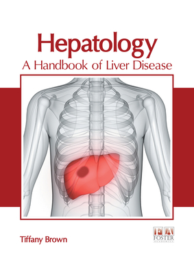 Hepatology: A Handbook of Liver Disease Cover Image