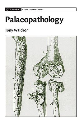 Palaeopathology (Cambridge Manuals in Archaeology) Cover Image