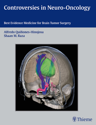 Controversies in Neuro-Oncology: Best Evidence Medicine for Brain Tumor Surgery Controversies in Neuro-Oncology: Best Evidence Medicine for Brain Tumor Surgery cover