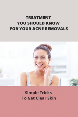 Treatment You Should Know For Your Acne Removals: Simple Tricks To Get Clear Skin By Weston Nawn Cover Image