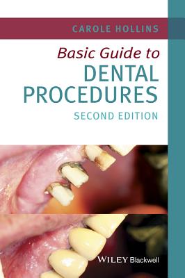 Basic Guide to Dental Procedures (Basic Guide Dentistry) Cover Image