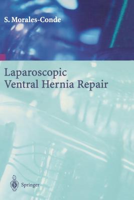 Laparoscopic Ventral Hernia Repair Cover Image