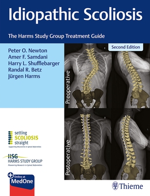 New Scoliosis Study