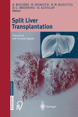 Split Liver Transplantation: Theoretical and Practical Aspects Cover Image