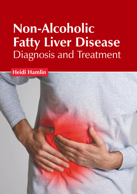 Non-Alcoholic Fatty Liver Disease: Diagnosis and Treatment Cover Image