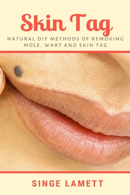 Skin Tag: Natural DIY Methods of removing Mole, Wart and Skin Tag By Singe Lamett Cover Image