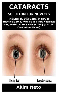 Cataracts Solution for Novices: The Step By Step Guide on How to Effectively Stop, Reverse and Cure Cataracts Using Herbs for Your Eyes (Curing your O Cover Image